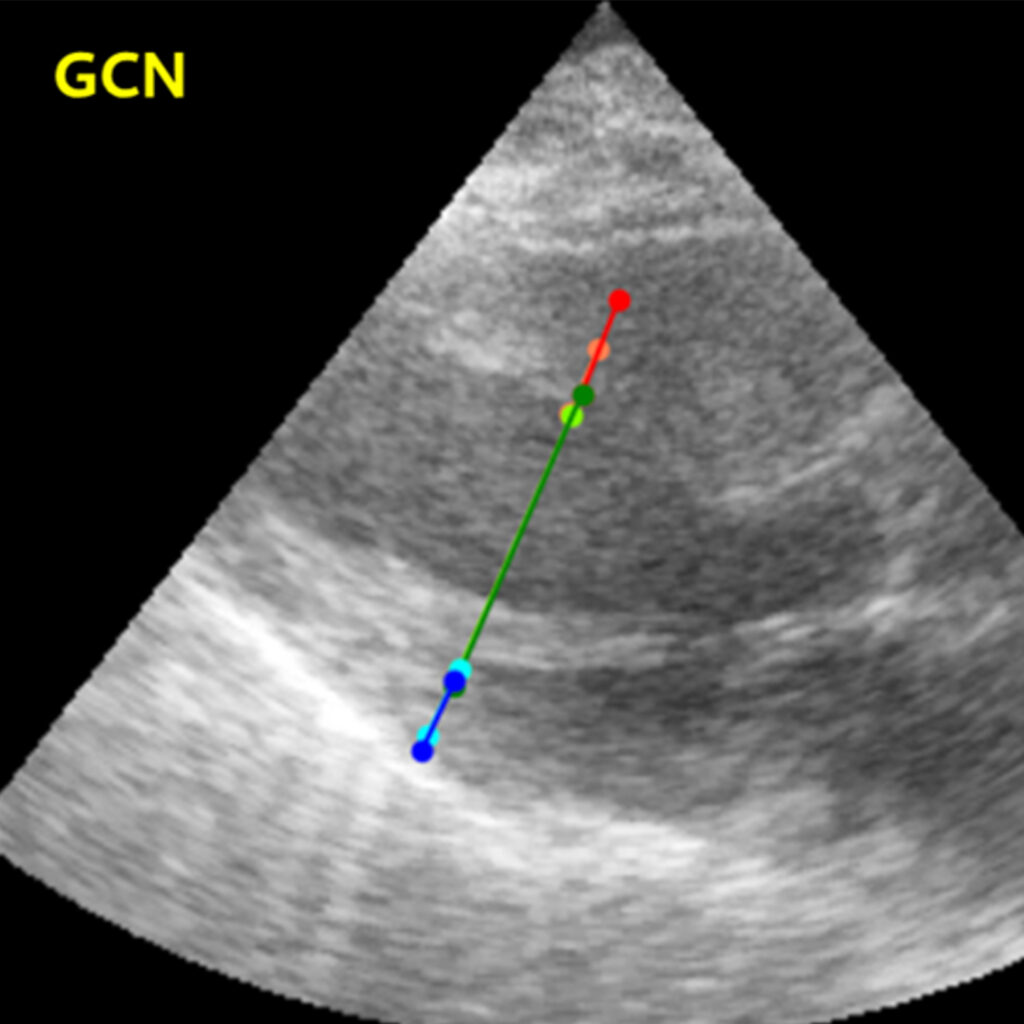 Bilde viser hvordan grafkonvolusjonsnettverket kartlegger målepunkter i et ultralydbilde av hjerte. Punktene er markert med linjer i blått, grønt og rødt. Ellers er bildet grått, hvitt og sort.